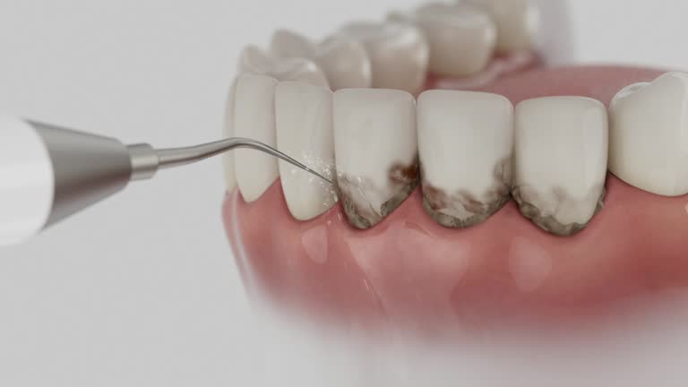 Trusted Dental Crowns And Bridges service in Columbia, KY - Dentist Open Now